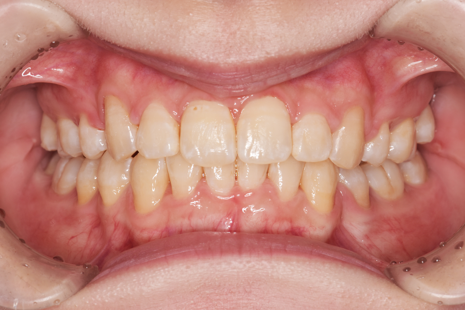 After
