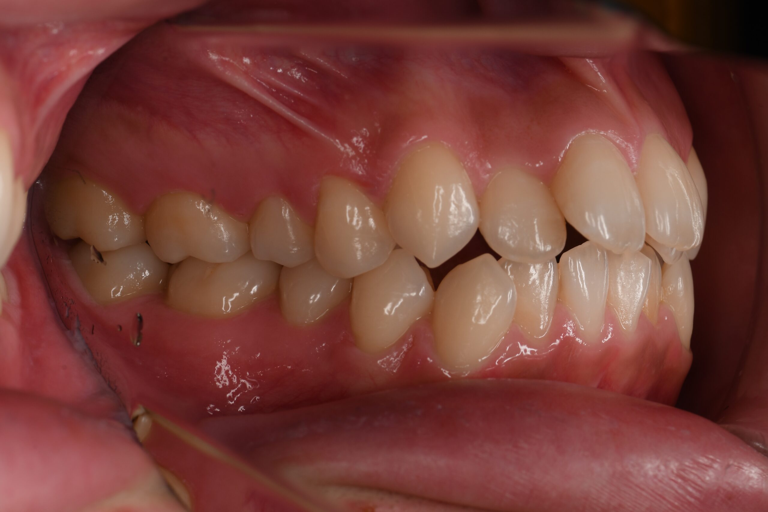 治療前