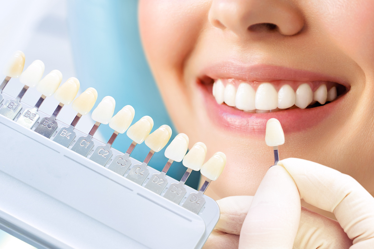 Smiling young woman. Cosmetological teeth whitening in a dental clinic. selection of the tone of the implant tooth.